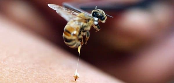 Укус пчелы: первая помощь