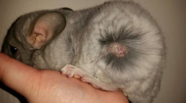 Грибковые инфекции