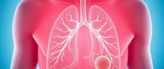 Пневмония без паники: понятное руководство по лечению